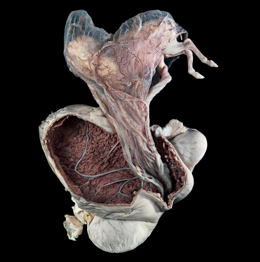 Picture 1 of The shocking images of medical science achievements in 2015