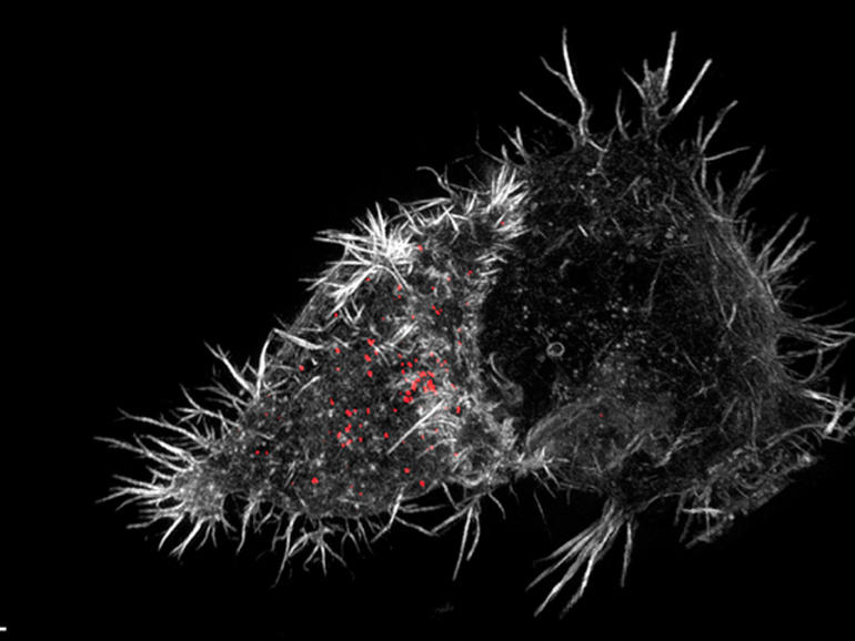 Picture 3 of The shocking images of medical science achievements in 2015