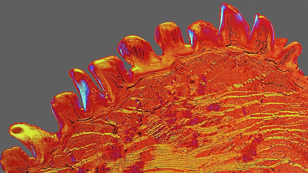 Picture 8 of The shocking images of medical science achievements in 2015