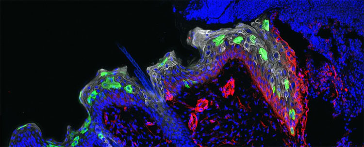 Picture 1 of The skin can also 'remember' disease