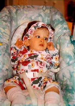Picture 1 of The slow-growing girl helps discover the aging mechanism