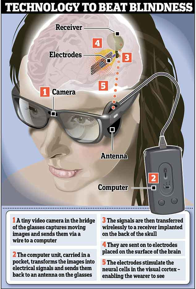 Picture 2 of The small chip will help blind people see