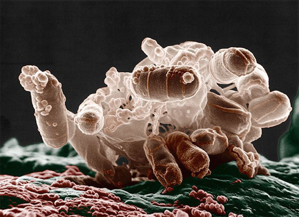 Picture 2 of The story of CRISPR: From bacteria to the great innovation of the 21st century