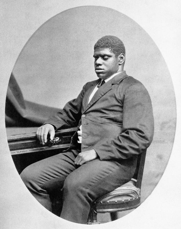 Picture 2 of The strange disease turns blind slaves into musical geniuses
