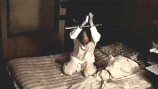 Picture 5 of The syndrome of
