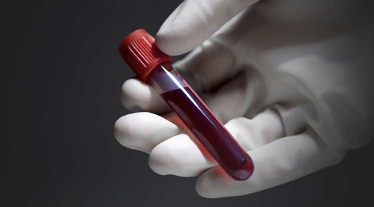 Picture 1 of The things doctors won't reveal in your blood test
