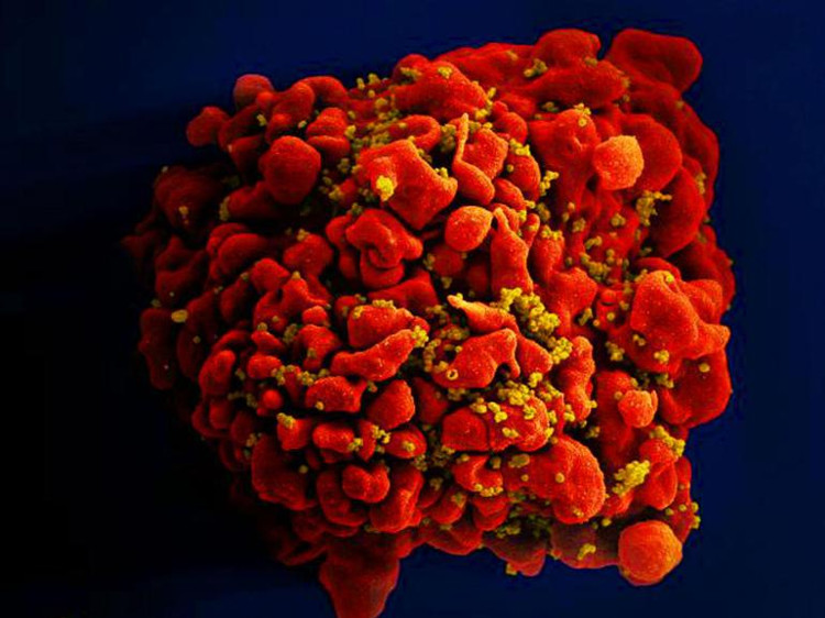 Picture 1 of The third case of HIV infection is cured in the world