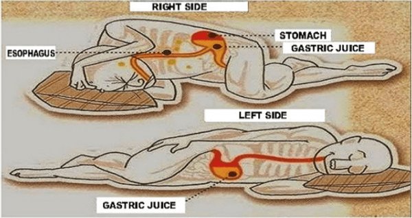 Picture 3 of The tips to help improve stomach problems are simple but effective