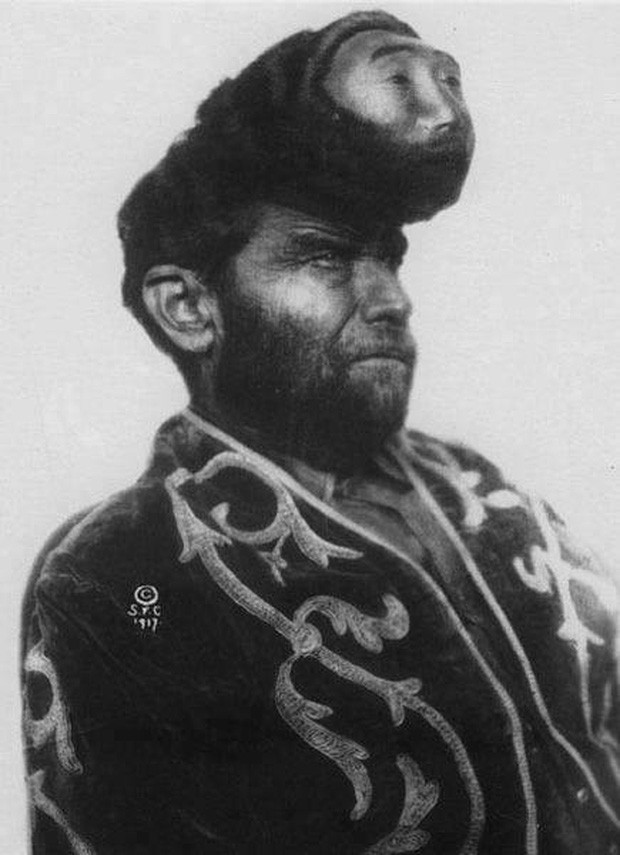 The truth about a man with two heads is very famous in Mexico images 1