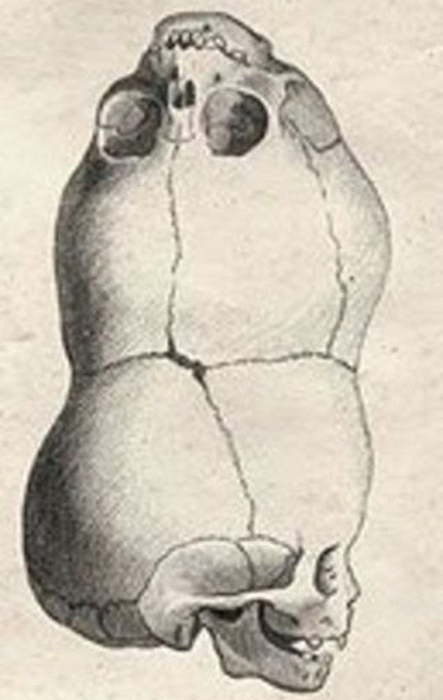 The truth about a man with two heads is very famous in Mexico images 4
