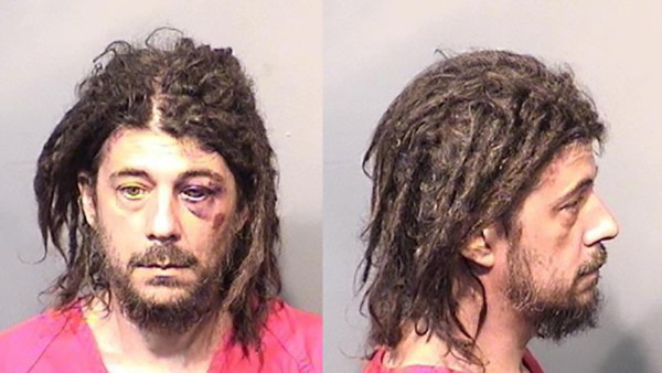 Picture 5 of The truth about drugs that destroys even more terrifying bodies than