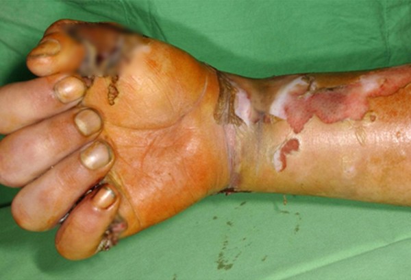 Picture 6 of The truth about drugs that destroys even more terrifying bodies than