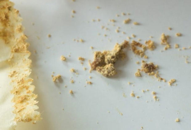 Picture 7 of The truth about the earwax method is said to be