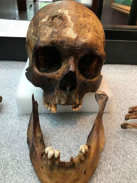Picture 2 of The truth about the 'vampire' remains was grave 200 years ago