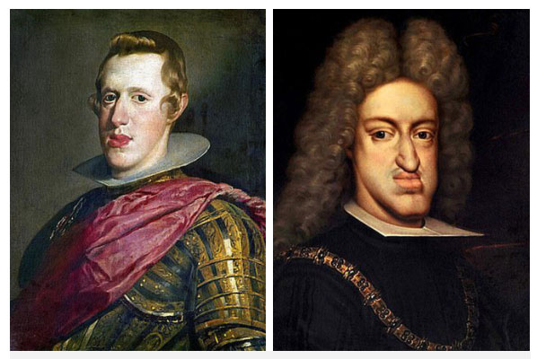 Picture 1 of The truth behind the 'jaw-dropping' disease haunted European royalty for 4 centuries
