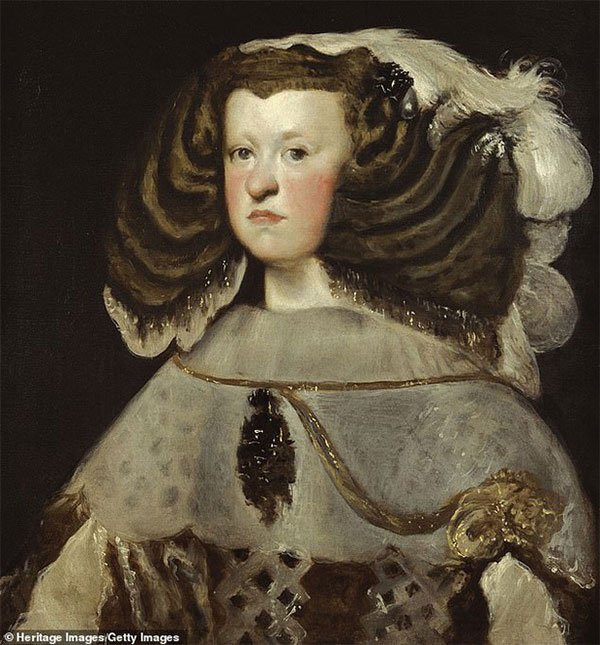 Picture 2 of The truth behind the 'jaw-dropping' disease haunted European royalty for 4 centuries