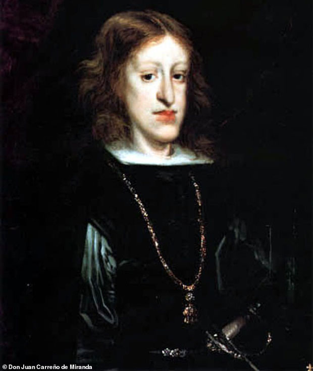 Picture 3 of The truth behind the 'jaw-dropping' disease haunted European royalty for 4 centuries