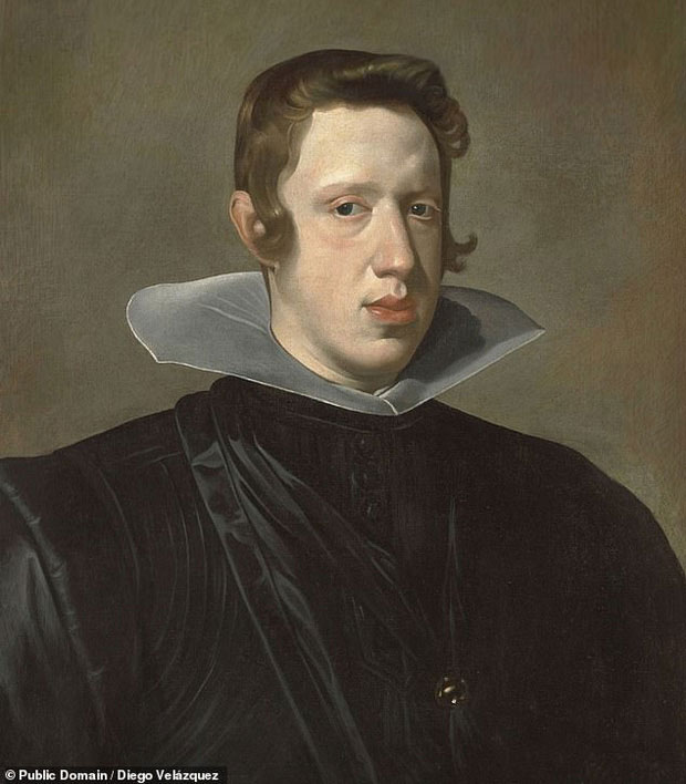 Picture 4 of The truth behind the 'jaw-dropping' disease haunted European royalty for 4 centuries