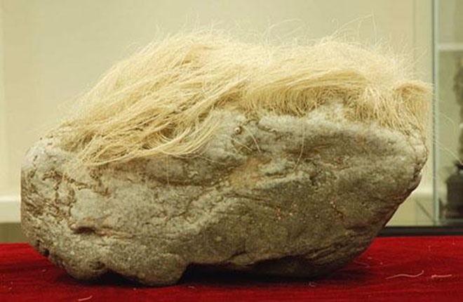 Picture 1 of The truth was startling behind the bizarre 'stone of white hair'