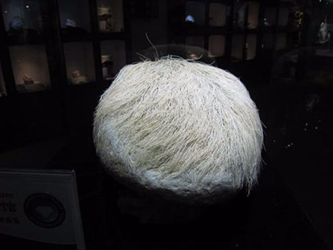 Picture 4 of The truth was startling behind the bizarre 'stone of white hair'