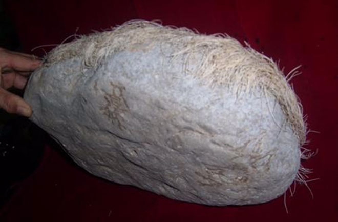 Picture 5 of The truth was startling behind the bizarre 'stone of white hair'