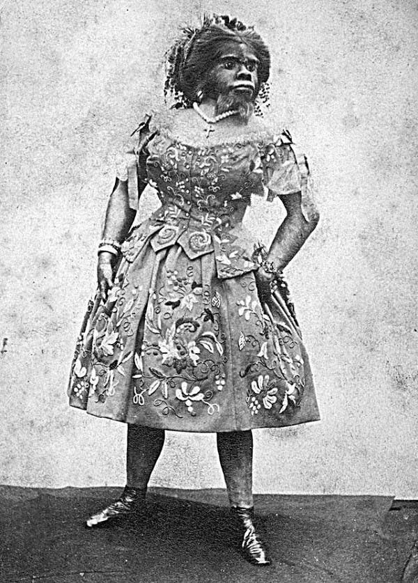 Picture 4 of The unfortunate life of the ugliest woman in the world