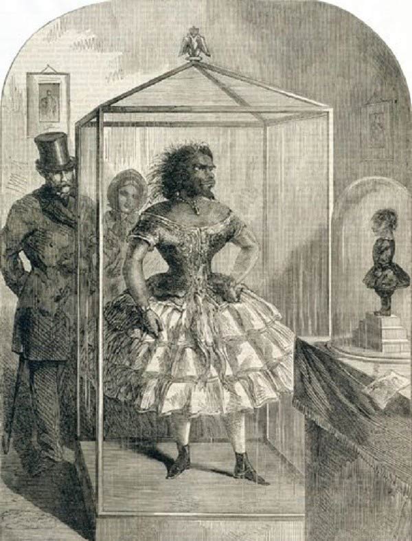 Picture 6 of The unfortunate life of the ugliest woman in the world