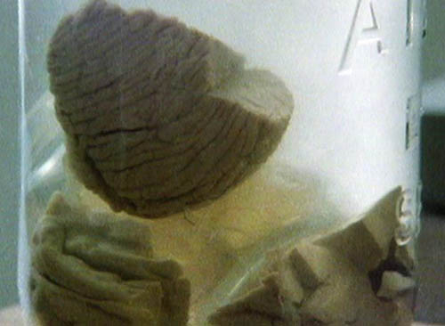 Picture 2 of The untold story about Einstein's brain