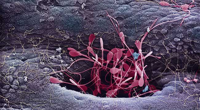 Picture 2 of The untold story of the sperm race: Stupid, comfortable, not as much as possible