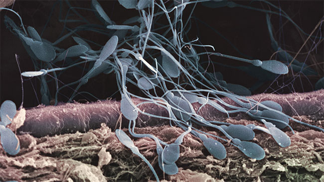 Picture 3 of The untold story of the sperm race: Stupid, comfortable, not as much as possible