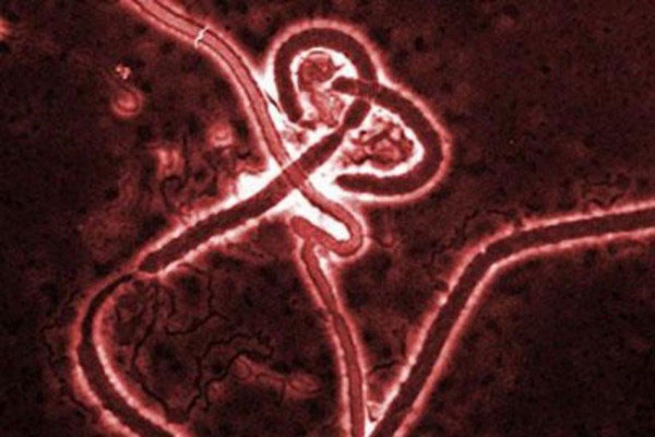 Picture 1 of The US admits Ebola can spread in the air
