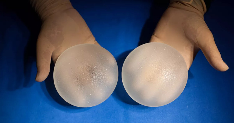 Picture 1 of The US warns that breast cancer bags are rare and hard to cure