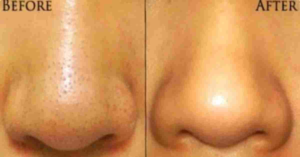 Picture 1 of The uses of baking soda surprise you