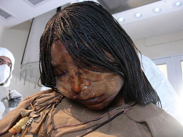 Picture 1 of The Virgin has tuberculosis before being sacrificed