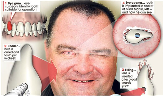 Picture 7 of The way to treat disgusting self-ancient needle