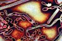 Picture 2 of The whole world is worried about outbreaks of bird flu?