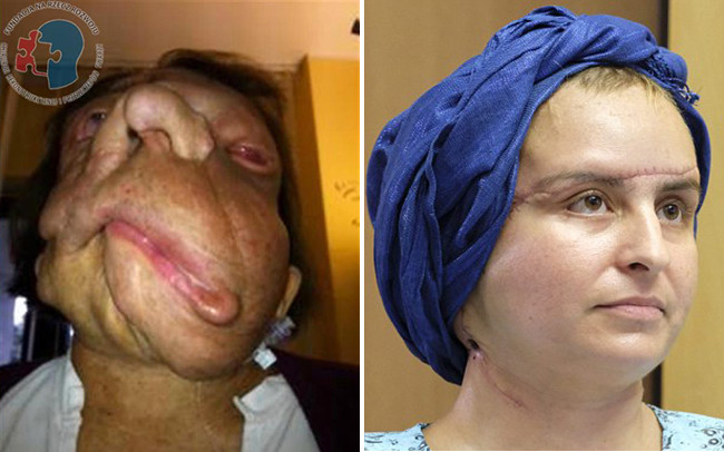 Picture 1 of The woman with the devil face became surprisingly beautiful after 3 years