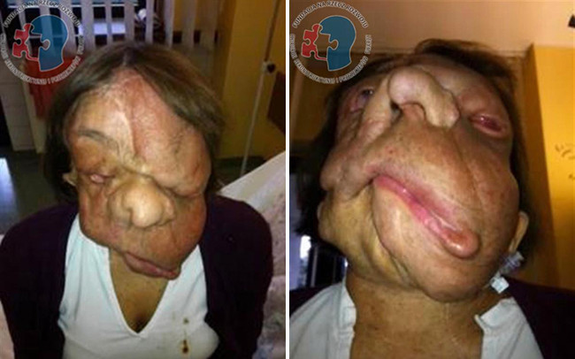 Picture 2 of The woman with the devil face became surprisingly beautiful after 3 years