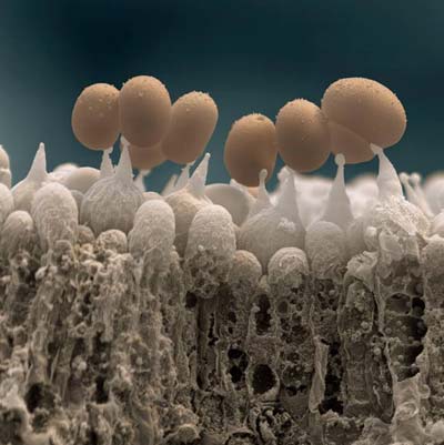 Picture 10 of The world goes through an electron microscope