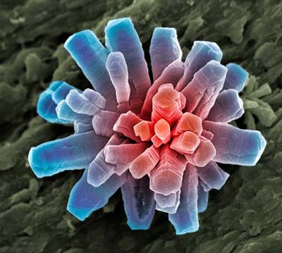 Picture 11 of The world goes through an electron microscope