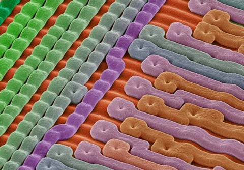 Picture 2 of The world goes through an electron microscope