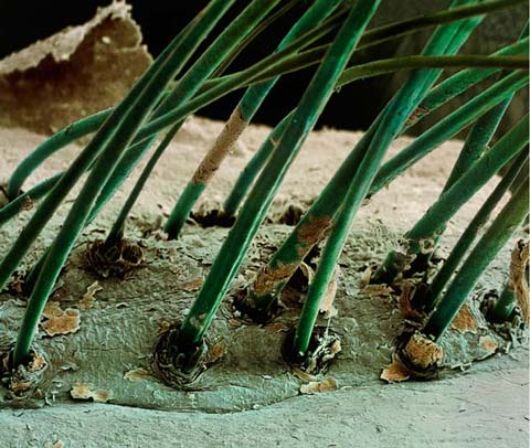 Picture 3 of The world goes through an electron microscope