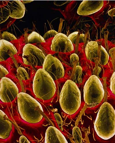 Picture 4 of The world goes through an electron microscope