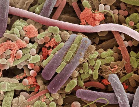 Picture 5 of The world goes through an electron microscope