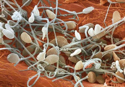 Picture 6 of The world goes through an electron microscope
