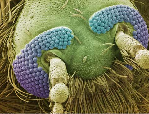 Picture 9 of The world goes through an electron microscope