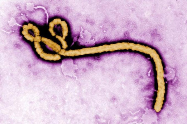 Picture 1 of The world is helpless before Ebola translation because ... sex