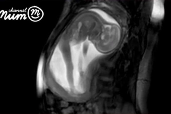 Picture 2 of The world's best ultrasound technology helps detect abnormalities in the fetus