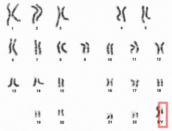Picture 2 of The Y chromosome is slowly degenerating