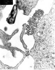 There is a risk of dengue fever complications on the brain images 1